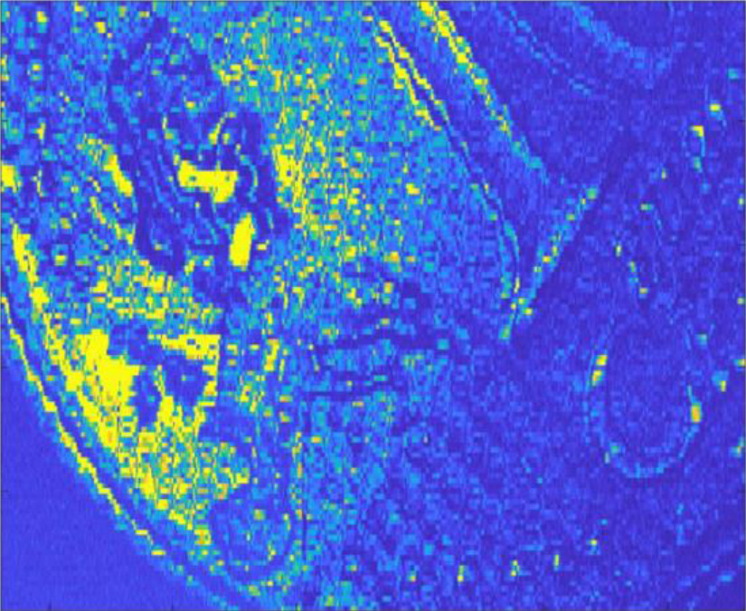 Lidar imaging